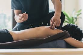 Traditional Acupuncture & Physiotherapy Center in KL
